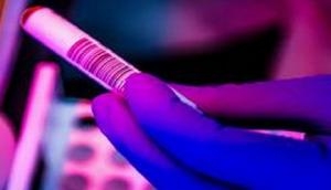 India crosses one million RT-PCR tests for COVID-19