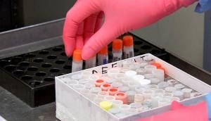 Coronavirus: Over 57.7 lakh COVID-19 tests done so far, says ICMR