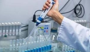 Coronavirus: Israel's Biological Institute completes development phase of COVID-19 antibody