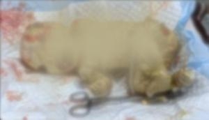 Unbelievable! Baby born with bizarre disease in UP's hospital; doctors left perplexed