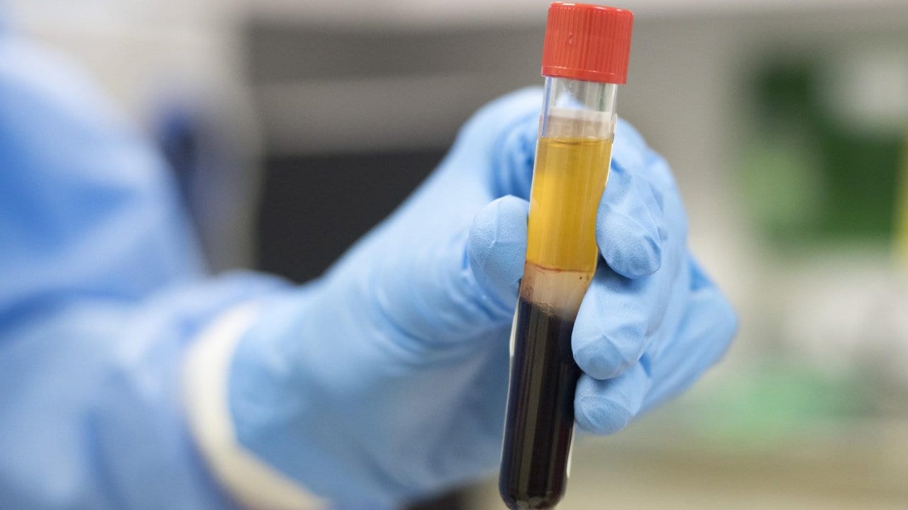 Punjab govt to provide plasma to private hospitals at Rs 20,000 per unit