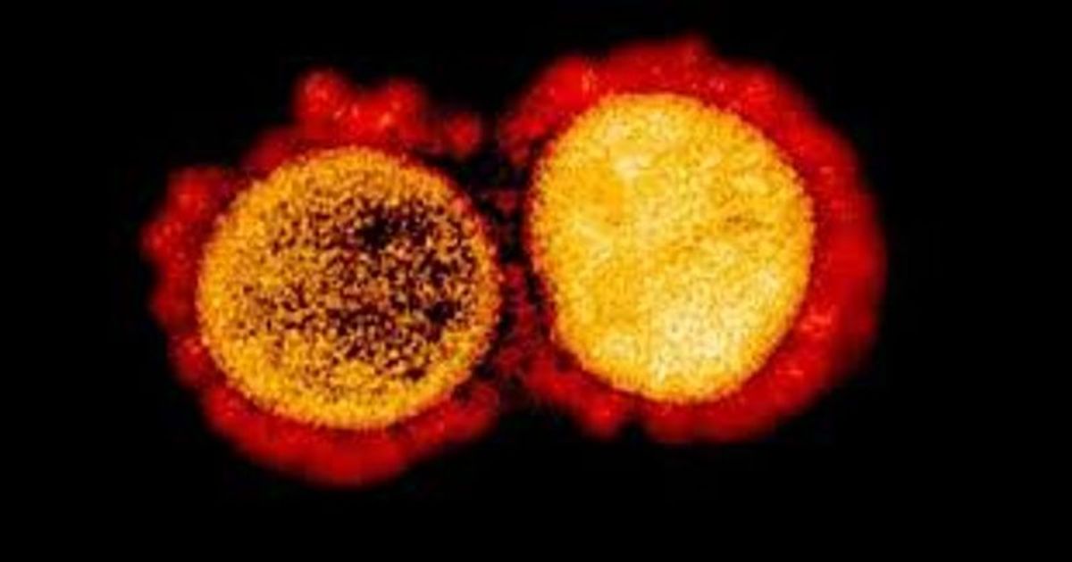 Scientists detect strain of new coronavirus which is 10 times more infectious