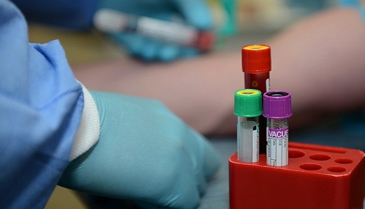 Coronavirus Update: India's COVID-19 tally crosses 48-lakh mark