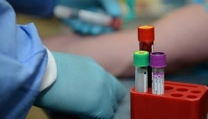 Coronavirus: Russia records 5,205 cases within 24 hours; tally rises to 1,020,310