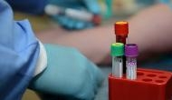 Coronavirus: Mizoram records 1,379; no deaths so far