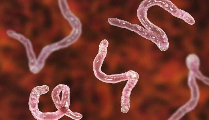 OMG! Woman left shocked after doctors find cyst full of tapeworm in her brain