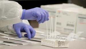 Coronavirus Pandemic: 10 inmates test positive for COVID-19 at Kanpur jail
