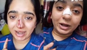 Zomato delivery man who gave bloody gash on woman's nose in Bengaluru nabbed