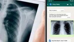 X-Ray Setu for COVID detection: Here's how to use app via WhatsApp