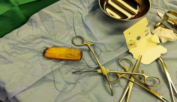 What? Man swallows mobile phone; what happens next will leave you open-mouthed!