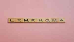 Scientists set to investigate new treatment strategy for lymphoma