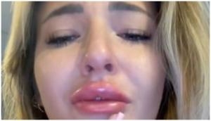 Woman left in tears after her cosmetic surgery; here's why
