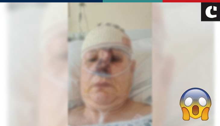 Woman gets 16 stitches on her face after dog attacked her; see disturbing images