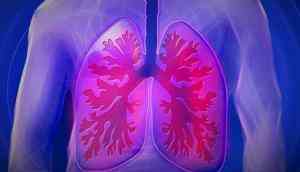 New model developed to predict patients with poor lung cancer outcomes: Research