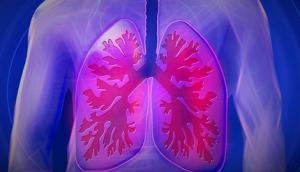New model developed to predict patients with poor lung cancer outcomes: Research