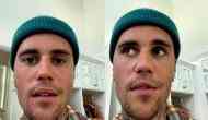 Half of Justin Bieber's face paralysed by serious virus, cancels shows