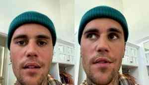 Half of Justin Bieber's face paralysed by serious virus, cancels shows