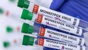 Delhi reports first case of Monkeypox with no travel history
