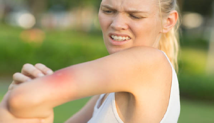 Mosquito Magnets! Ever wondered why mosquitoes bite you but not your friends?