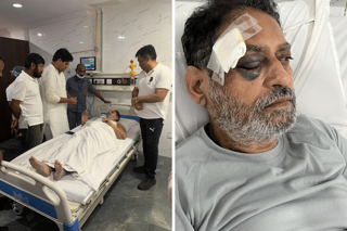 Congress leader Nitin Raut injured during Bharat Jodo Yatra in Telangana 