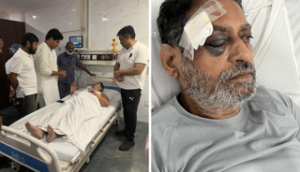 Congress leader Nitin Raut injured during Bharat Jodo Yatra in Telangana 