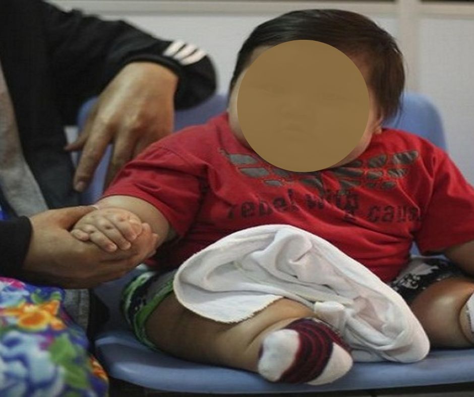 Child body weight has limited effect on mood, behavioural issues: Study