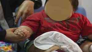 Child body weight has limited effect on mood, behavioural issues: Study