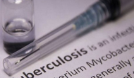 India develops mathematical model for estimation of TB burden cases, first country to do so