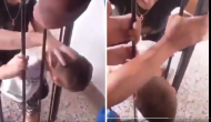 Viral Video: Neck stuck between iron rods; most people suggest the wrong solution!