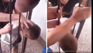 Viral Video: Neck stuck between iron rods; most people suggest the wrong solution!