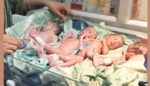 'Rare Birth: Tribal Woman Gives Birth to Quadruplets, All Healthy
