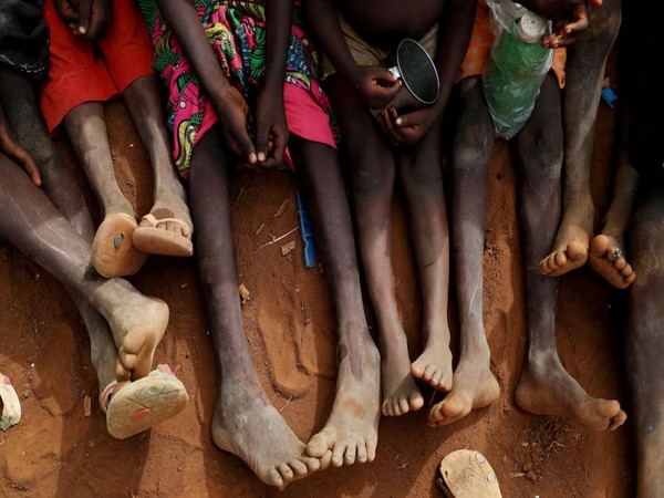 Over 3,000 Palestinian children admitted with acute malnutrition, says UN report