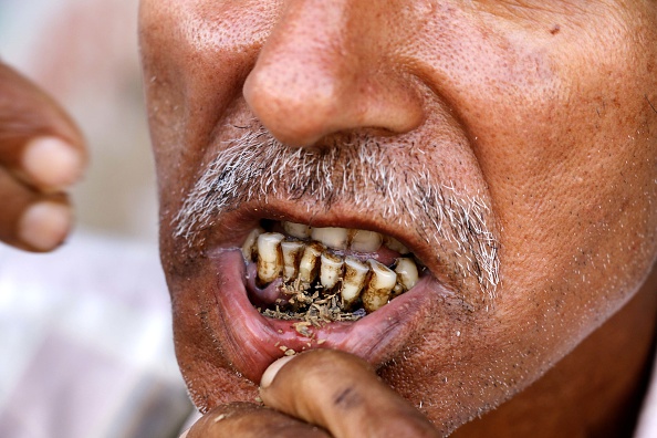Tobacco stained teeth_Anand Sharma/Pacific Press/LightRocket via Getty Images