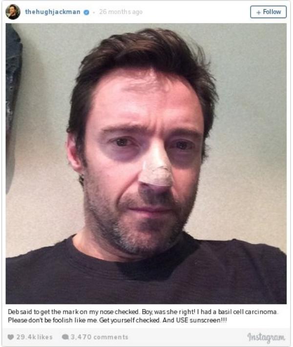 Hugh Jackman cancer.jpg