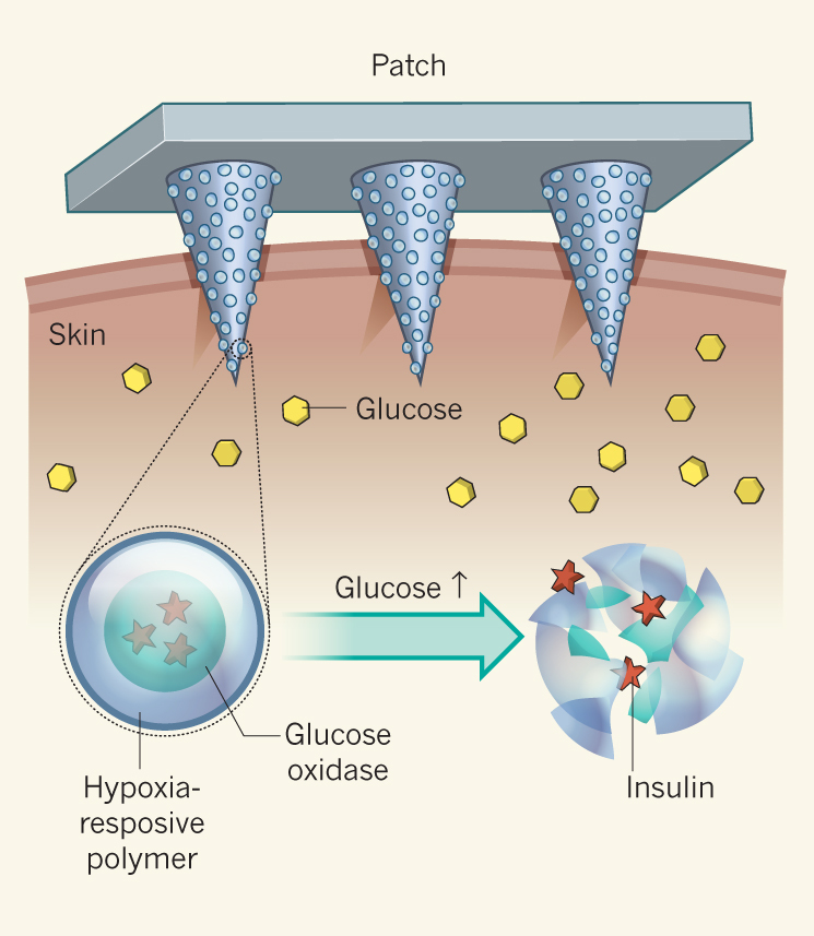 smart insulin patch.jpg