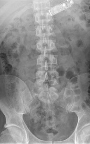 mobile phone in stomach.jpg