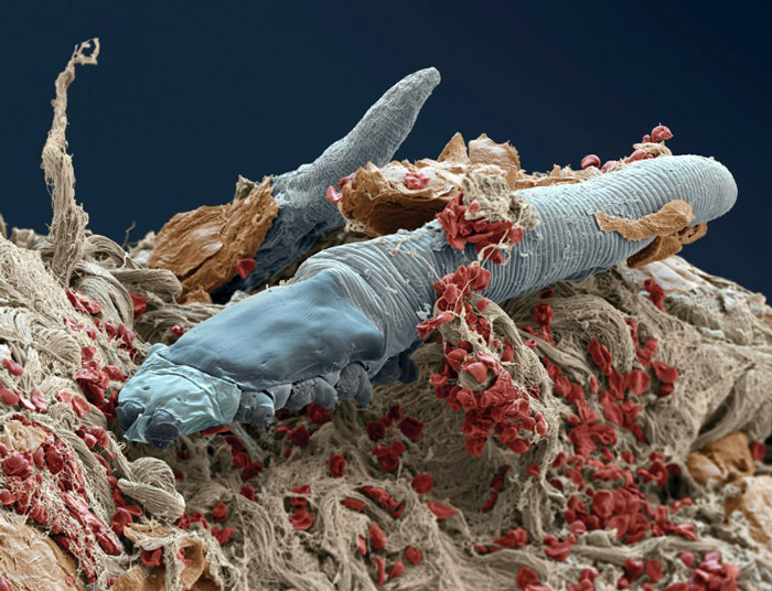 Face Off: your face is home to mites, and they've stuck with you for generations 