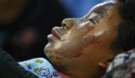 Men carry out five acid attacks in London in 70 minutes