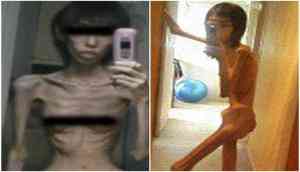 Grandfather starved girl almost to death