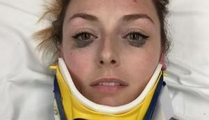 Viral eyeliner review: 25-year-old nurse from Boston posts make review, post terrible car accident