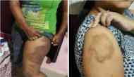 Odisha: Girls cry allegedly thrashed, beaten by police in Bhubaneshwar; cops transferred after video of the assault went viral