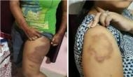 Odisha: Girls cry allegedly thrashed, beaten by police in Bhubaneshwar; cops transferred after video of the assault went viral