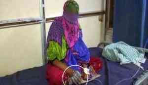Gujarat: Shocking! A woman shoves 17-years-old girl and husband's hands in hot oil on suspicion of duo having an affair