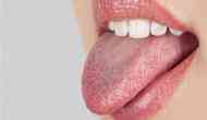 OMG! 63-year-old mysteriously gets pregnant from mouth after eating sperm in raw calamari; doctors found 12 bug emdedded in her tongue
