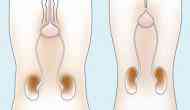 How healthy bladder can be maintained with urinary catheter?