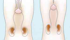 How healthy bladder can be maintained with urinary catheter?