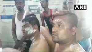 Karnataka Civic Elections: At least 10 injured in an acid attack on Congress' victory rally post poll results announcement