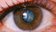 Delhi eye centre fined Rs 15 lakh for doing a shocking thing with a woman suffering from cataract