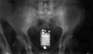 Kolkata: Shocking! Jail inmate caught with mobile phone, swallows device; what happened next will blow you hard!