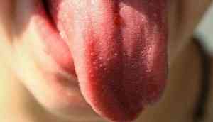 Shocking! Husband allegedly chops off wife's tongue, kept her captive over an argument over dowry; case registered